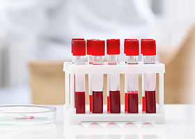 Комплексные анализы со скидкой в октябре Комплексные анализы со скидкой в октябре