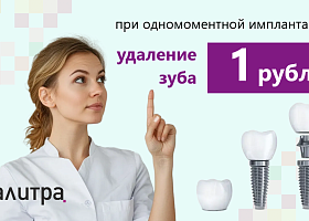 Удаление зуба за 1 рубль при одномоментной имплантации Удаление зуба за 1 рубль при одномоментной имплантации